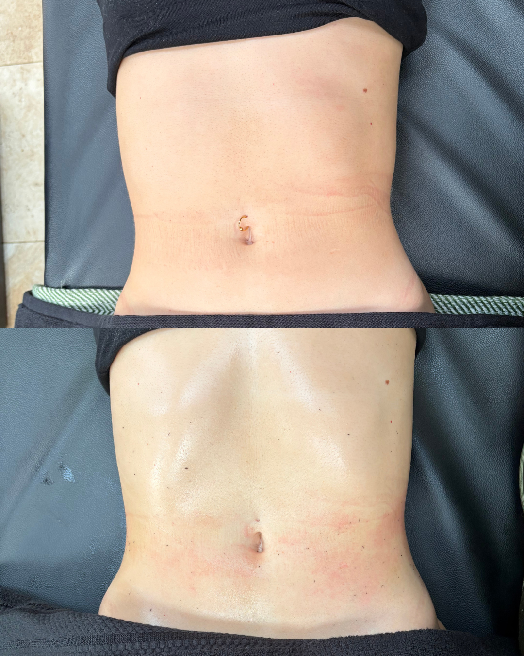 Mobile lymphatic drainage treatment setup