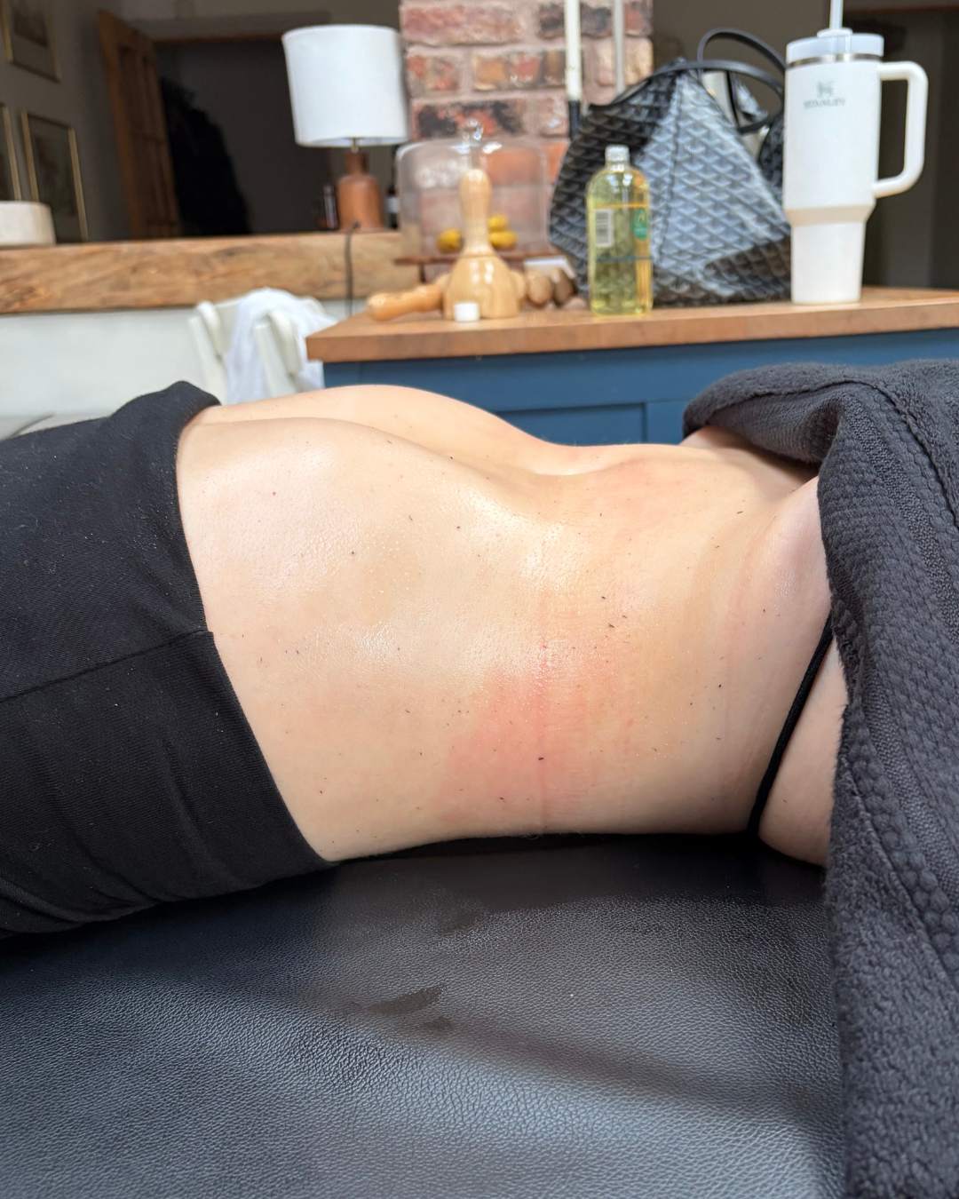 Detail of the Bare Lymphatics treatment space
